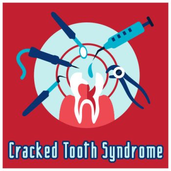 Sugar Hill dentist, Dr. Jonathan Chang at Sweet City Smiles, discuss the causes, symptoms, and treatment of cracked tooth syndrome.