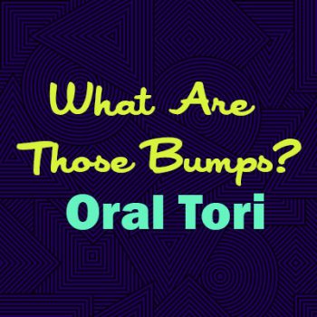 Sugar Hill dentist, Dr. Chang at Sweet City Smiles, explains oral tori—what they are, why they happen, and whether they are a cause for concern.