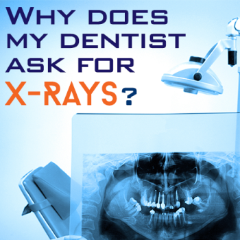 Sugar Hill dentist, Dr. Chang at Sweet City Smiles, discusses the importance of dental x-rays for accurate diagnosis and treatment planning.