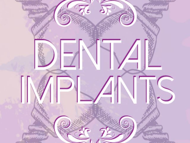 Facts About Dental Implants (featured image)