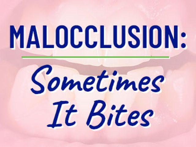 Malocclusion: Sometimes It Bites (featured image)